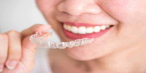 How Much Does Invisalign Cost? Here’s What To Expect 2025